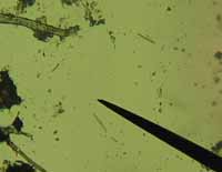 diatoms